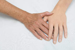 trẻ hóa của làn da của bàn tay
