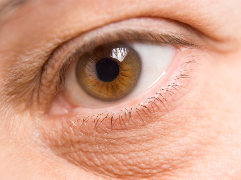 vùng da quanh mắt và sự trẻ hóa của nó bằng tia laser