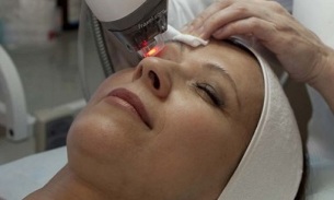 tạo hình môi để trẻ hóa vùng da quanh mắt